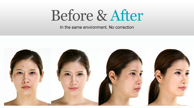 Before & After